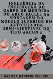 Influência da inclinação do garfo de mordida do arco facial na montagem do modelo superior em articulador semi-ajustável do tipo arcon e não-arcon

Faculdade de Odontologia de Ribeirão Preto / Reabilitação Oral
Universidade de São Paulo

"Durante o processo ensino/aprendizagem em Odontologia, é comum a ocorrência de inclinações do garfo de mordida em relação ao plano oclusal maxilar dos pacientes durante a tomada do arco facial realizada por alunos. Este trabalho avaliou a influência das inclinações do garfo de mordida para anterior e para posterior em relação ao plano oclusal na montagem do modelo maxilar em articuladores semi-ajustáveis do tipo arcon e não-arcon. [...] O trabalho sugere que pequenas inclinações do garfo de mordida não comprometem a tomada do arco facial e sua transferência para articuladores semi-ajustáveis."

 grátis de Reabilitação Oral . online na melhor biblioteca do Mundo!