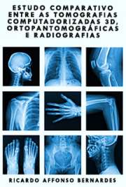  Estudo comparativo entre as tomografias computadorizadas 3D, ortopantomográficas e radiografias periapicais no diagnóstico de lesões periapicais, fraturas ra Faculdade de Odontologia de Bauru / Endodontia