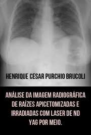   Análise da imagem radiográfica de raízes apicetomizadas e irradiadas com laser de Nd:YAG por meio do processamento de imagem de radiografias digitais diretas Faculdade de Odontologia / Diagnóstico Bucal