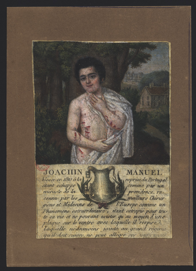 Joachin Manuel blessé en 1810 à la reprise du Portugal... [ca 1815?]. - 1 desenho : óleo sobre pergaminho, color. ; 11,5x8 cm